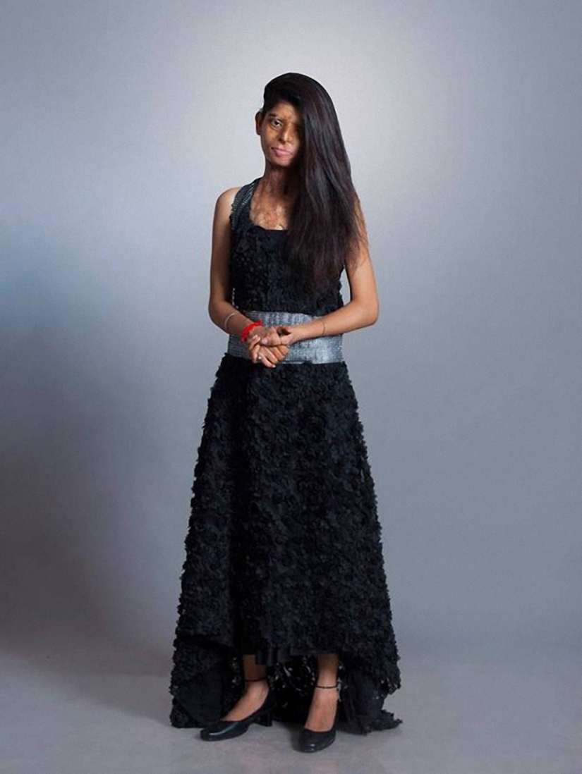 Modelos de India mutilados con ácido