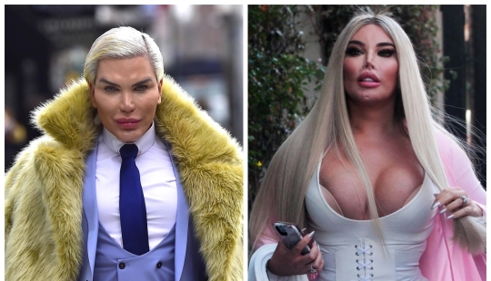 New body — new love: the doll-man Alves became a woman and had an affair with an Italian