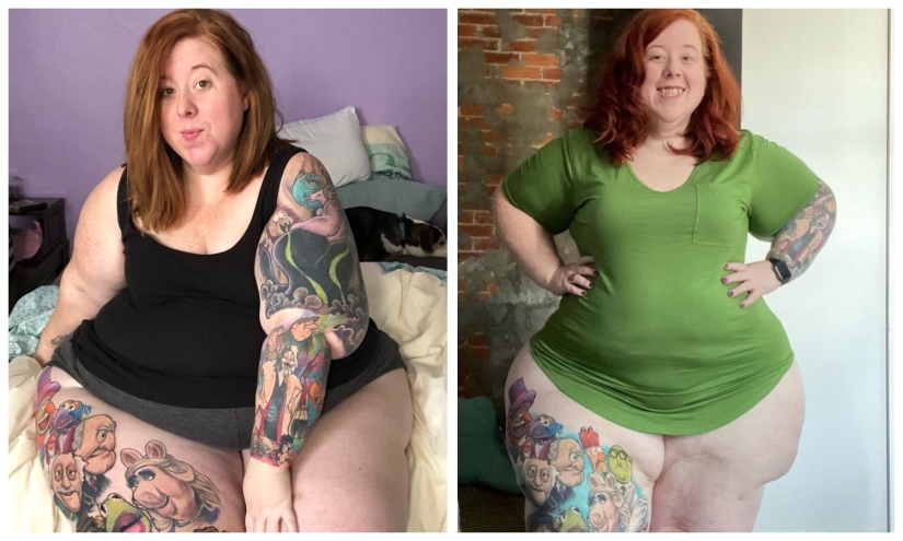 No comer en exceso, sino una enfermedad: una mujer estadounidense está luchando con lipedema con la ayuda de operaciones