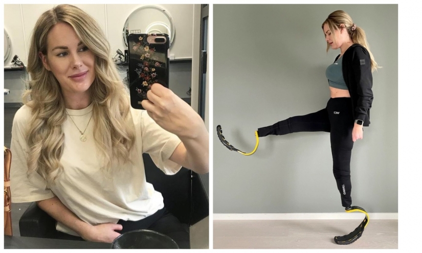 No legs, but with the will to survive: how a young mother lost a limb, but has not lost the power of the spirit No legs, but with the will to survive: how a young mother lost a limb, but has not lost the power of the spirit