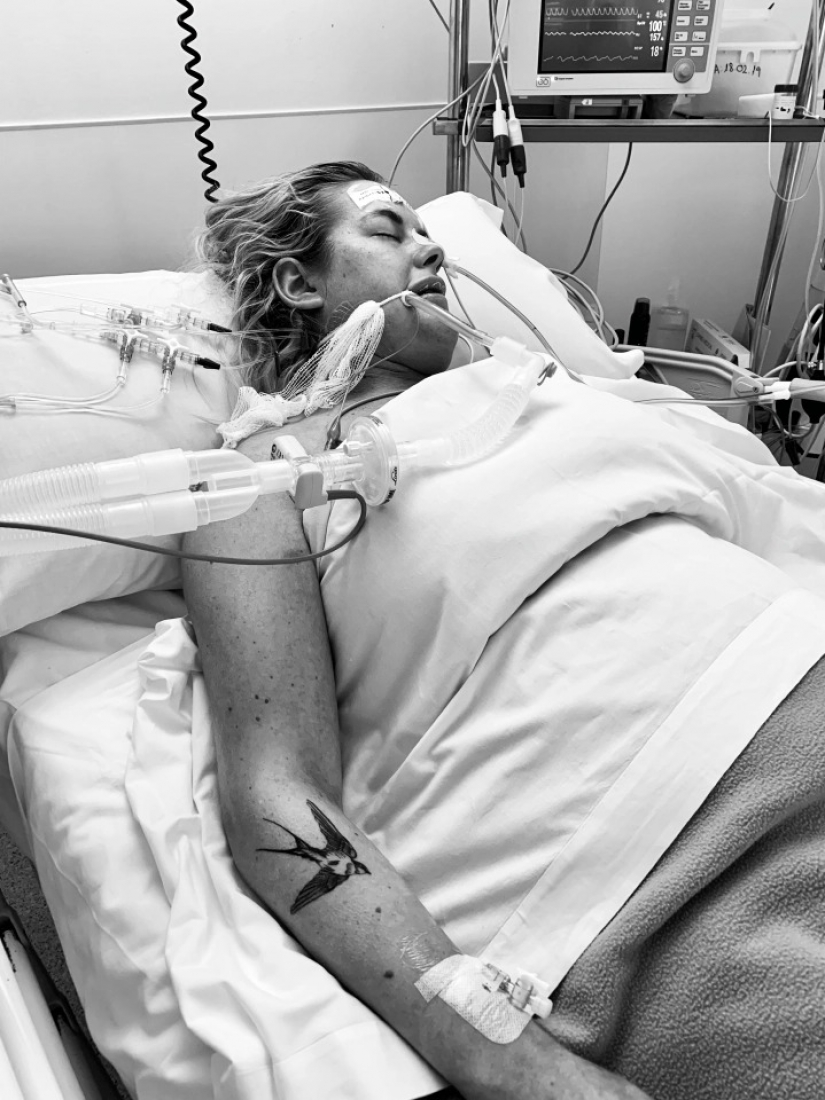 No legs, but with the will to survive: how a young mother lost a limb, but has not lost the power of the spirit No legs, but with the will to survive: how a young mother lost a limb, but has not lost the power of the spirit