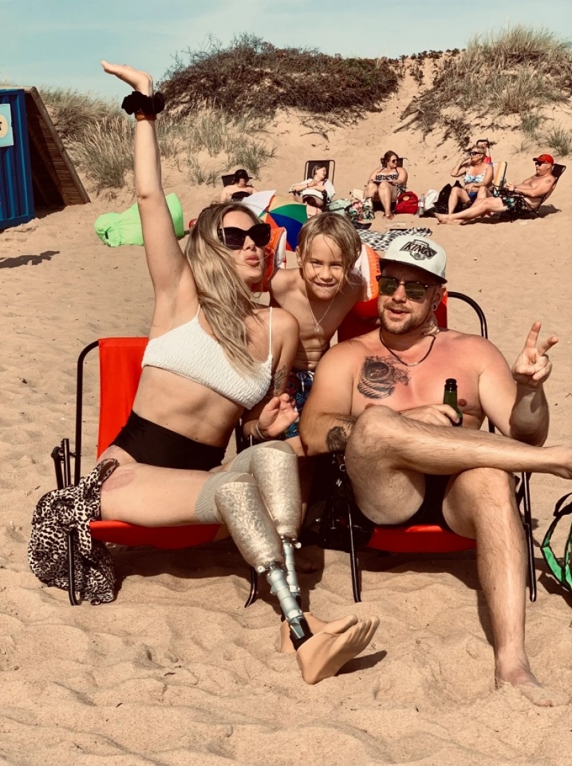 No legs, but with the will to survive: how a young mother lost a limb, but has not lost the power of the spirit No legs, but with the will to survive: how a young mother lost a limb, but has not lost the power of the spirit