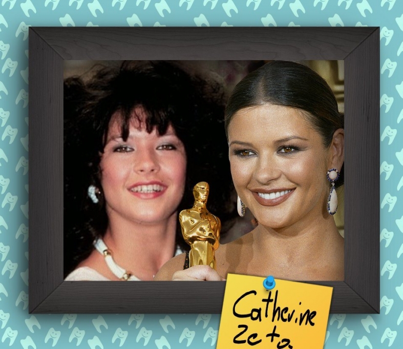 Non-Hollywood smiles of stars at the beginning of their careers