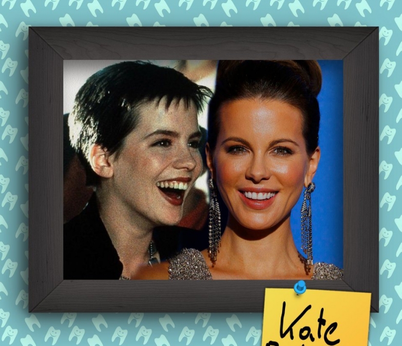 Non-Hollywood smiles of stars at the beginning of their careers