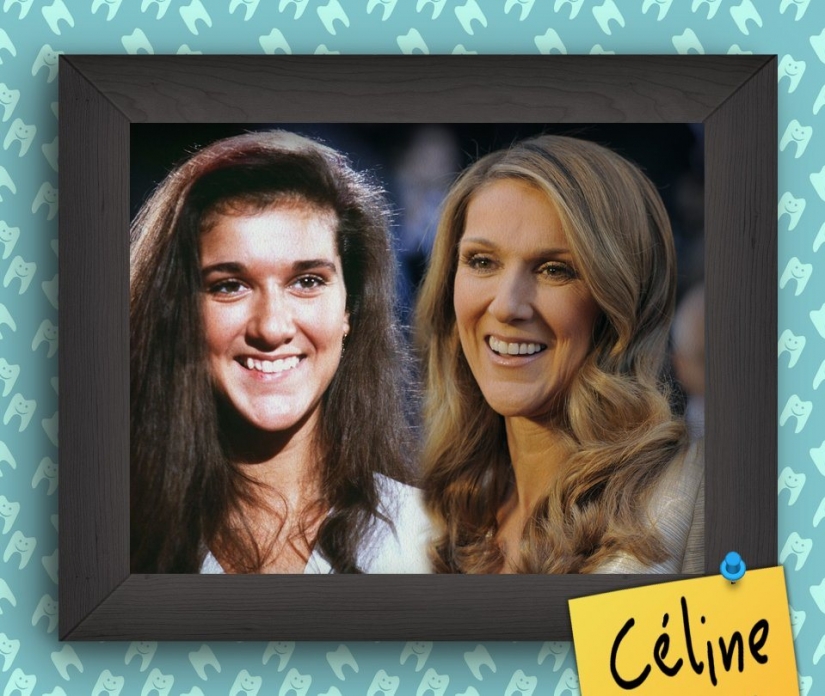 Non-Hollywood smiles of stars at the beginning of their careers