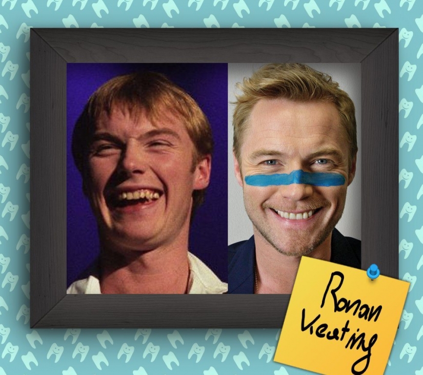 Non-Hollywood smiles of stars at the beginning of their careers