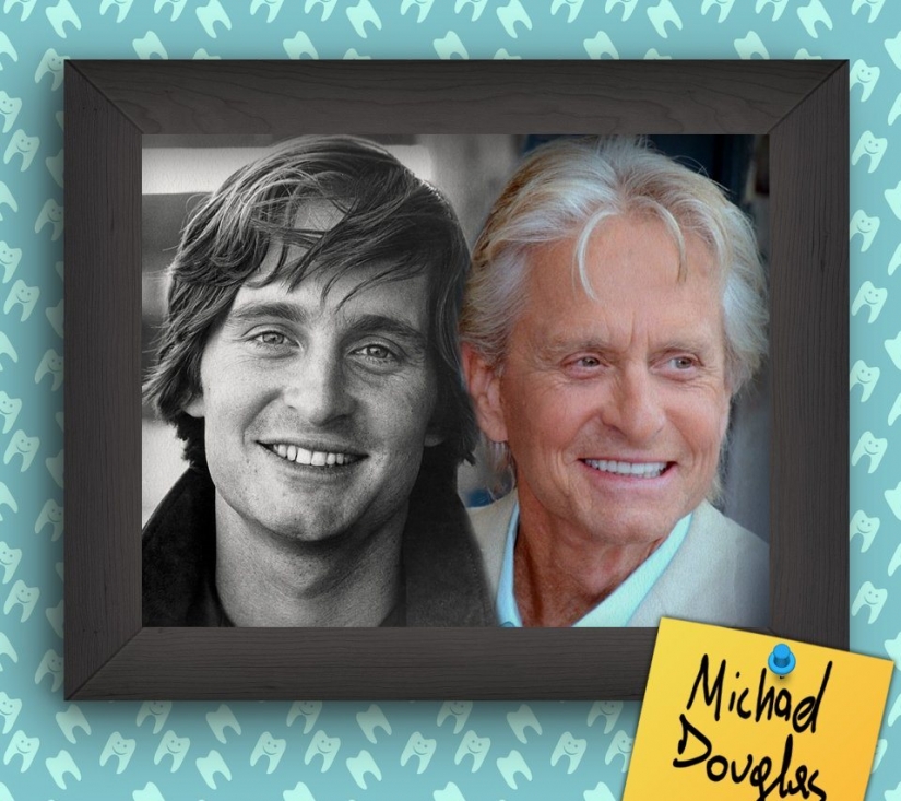 Non-Hollywood smiles of stars at the beginning of their careers