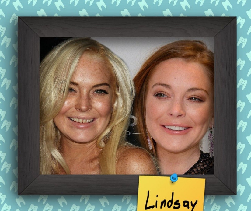 Non-Hollywood smiles of stars at the beginning of their careers