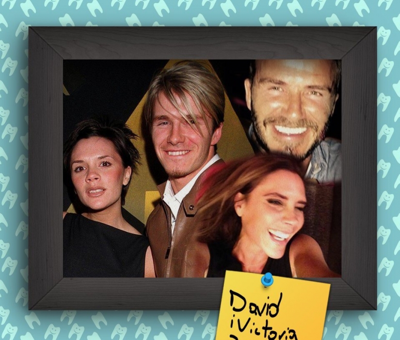 Non-Hollywood smiles of stars at the beginning of their careers