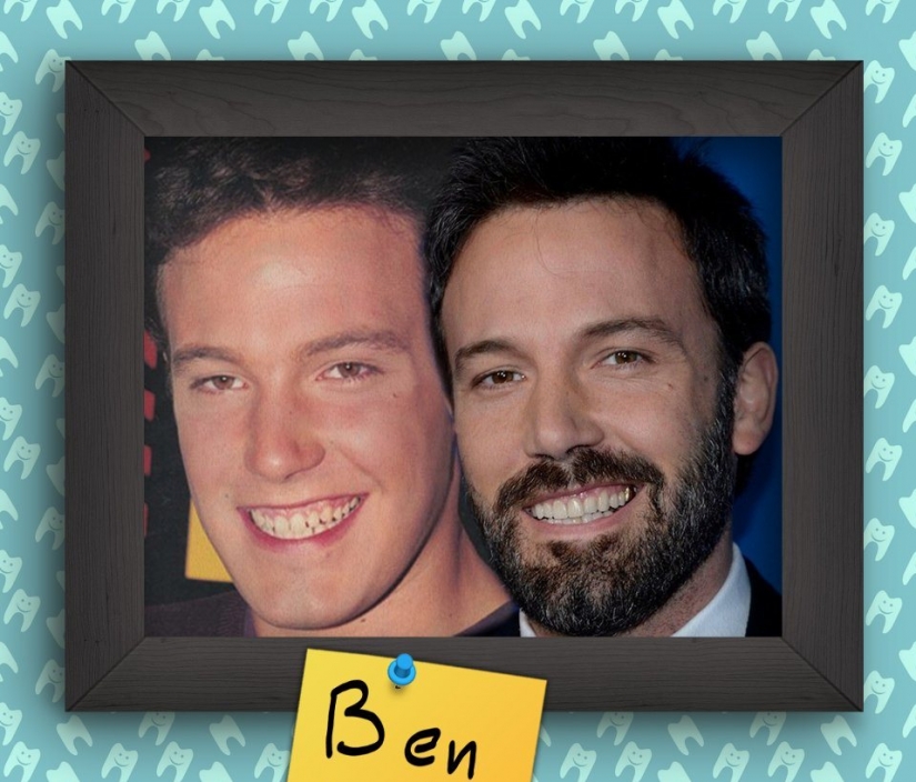 Non-Hollywood smiles of stars at the beginning of their careers