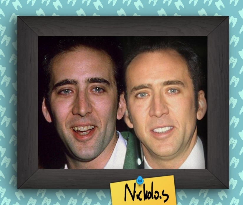 Non-Hollywood smiles of stars at the beginning of their careers