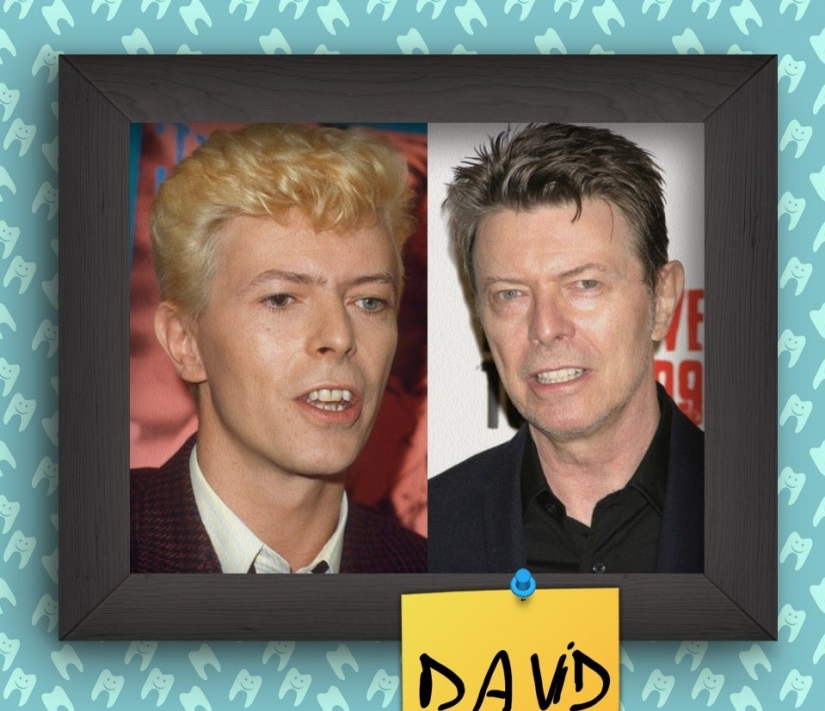 Non-Hollywood smiles of stars at the beginning of their careers