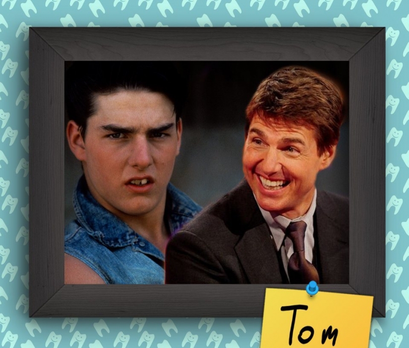 Non-Hollywood smiles of stars at the beginning of their careers