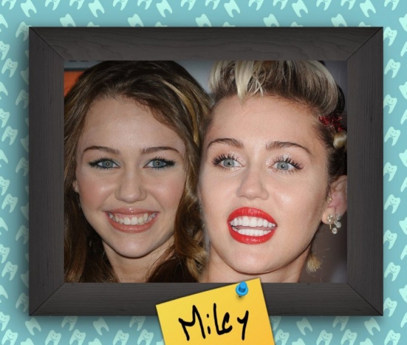 Non-Hollywood smiles of stars at the beginning of their careers