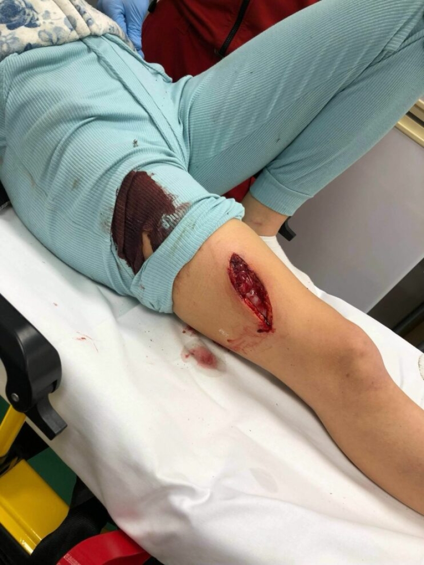 Norwegian blogger almost died during a selfie with a domestic pig