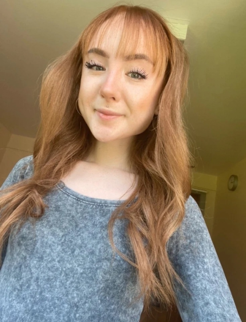 On the edge of the abyss: how a young Scottish woman weighing 25 kg was able to overcome anorexia