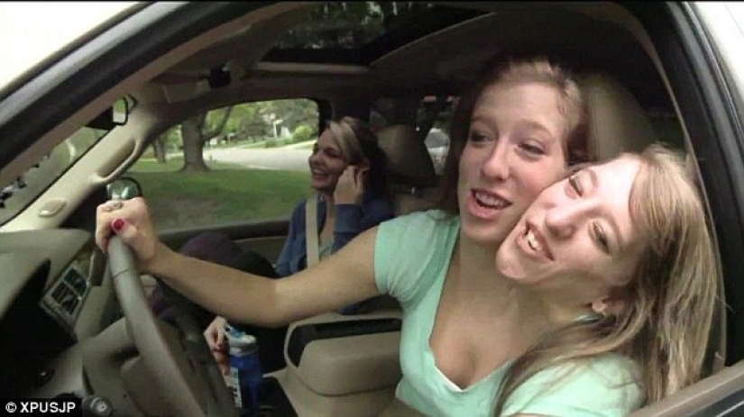 One body for two: how do Siamese twins Abigail and Brittany Hensel live?