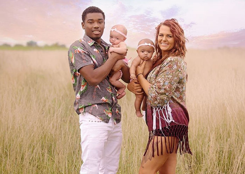 One is white, the other is tanned: a rare case of twins being born with different skin colors