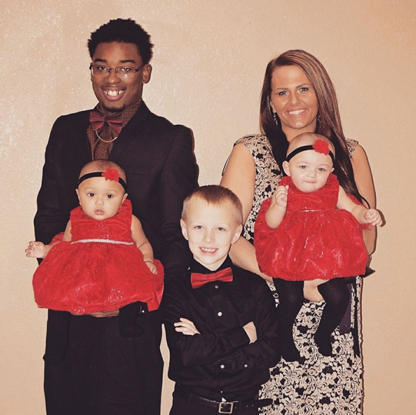 One is white, the other is tanned: a rare case of twins being born with different skin colors