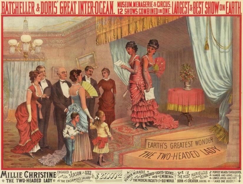 One life for two people without strain and tragedies: a happy Siamese twins