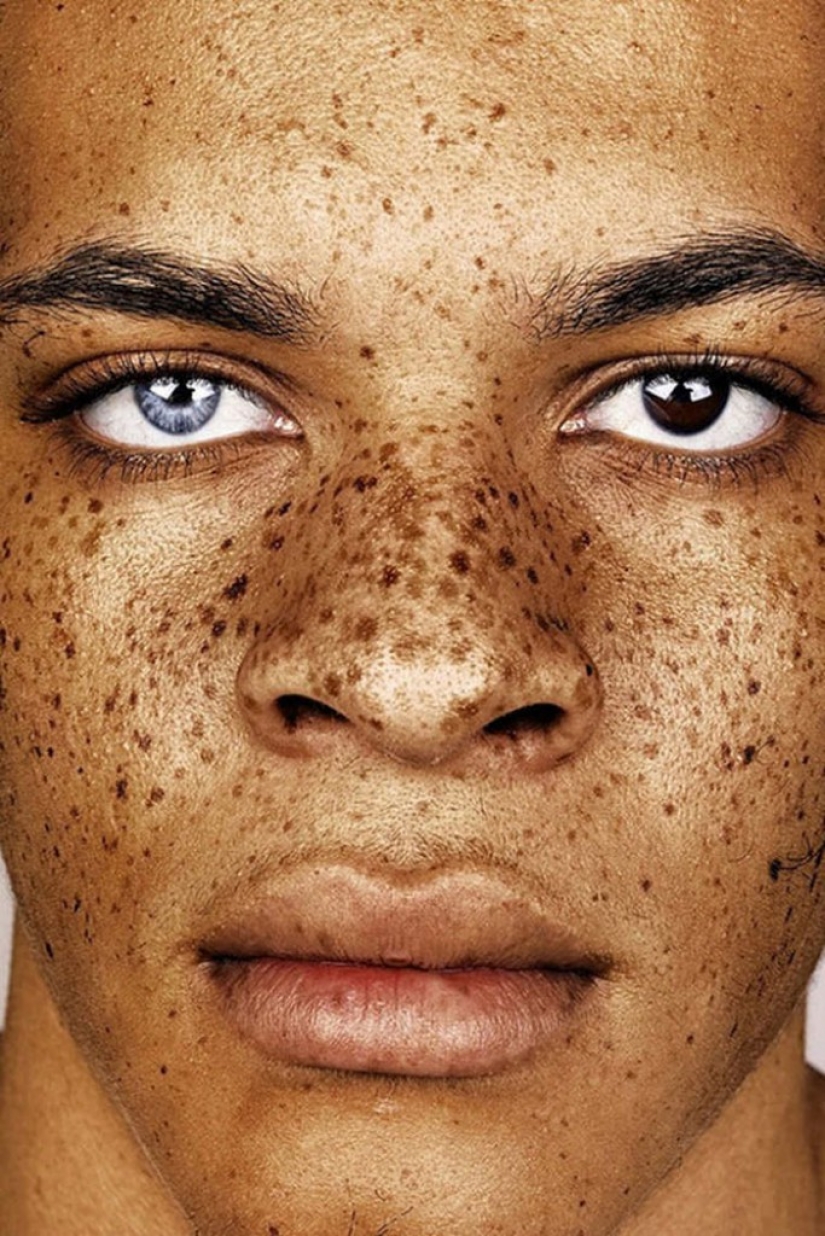 People with freckles are adorable