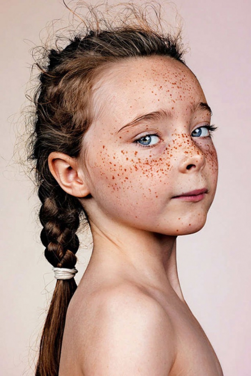 People with freckles are adorable