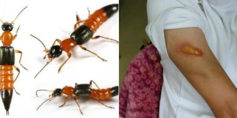 Perverts, cockroaches and cold in the winter: the Russian spoke about the difficulties of life in Japan