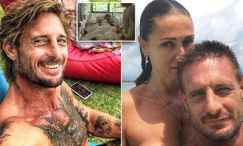 Photographer-surfer brad masters died in Bali from a strange infection that struck the neck Photographer-surfer brad masters died in Bali from a strange infection that struck the neck