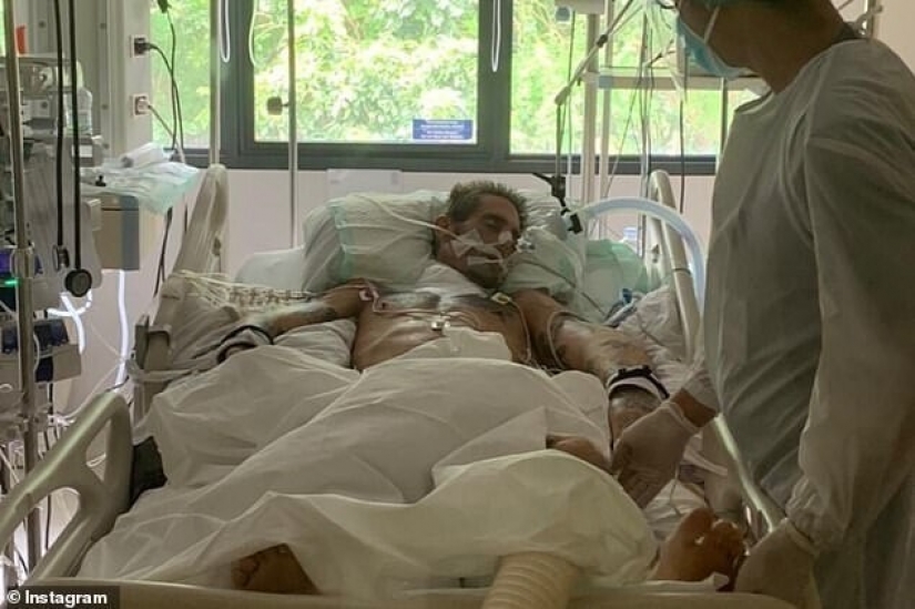 Photographer-surfer brad masters died in Bali from a strange infection that struck the neck Photographer-surfer brad masters died in Bali from a strange infection that struck the neck