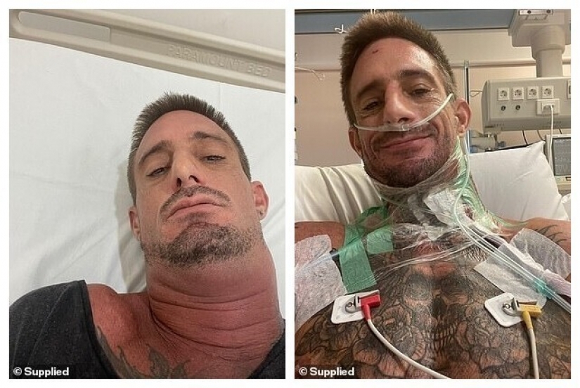 Photographer-surfer brad masters died in Bali from a strange infection that struck the neck Photographer-surfer brad masters died in Bali from a strange infection that struck the neck