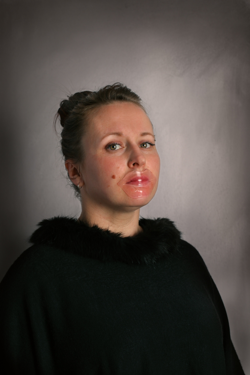 Pinza en la nariz y labios de pato: lo que las mujeres están listas para por el bien de la belleza y la juventud