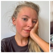 Poisoned life: a British woman almost died because of mold in the house