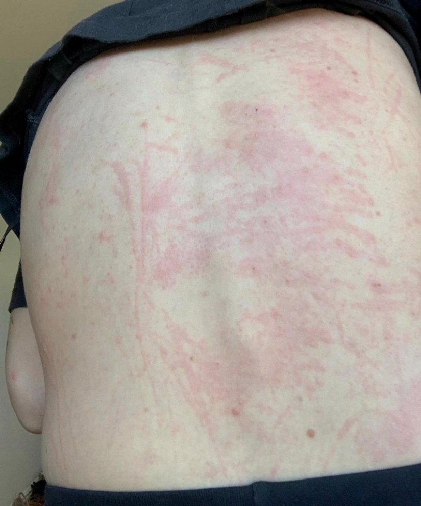 Poisoned life: a British woman almost died because of mold in the house Poisoned life: a British woman almost died because of mold in the house