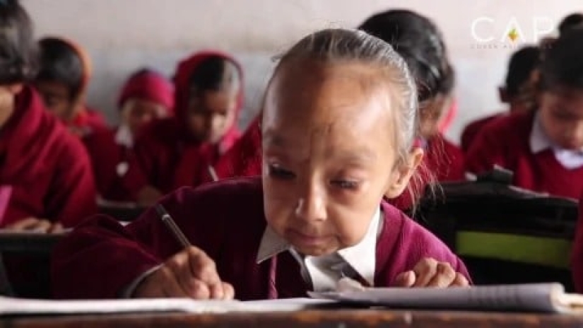 ¿Por qué los hermanos de la India parecen viejos? ¿Por qué los hermanos de la India parecen viejos?