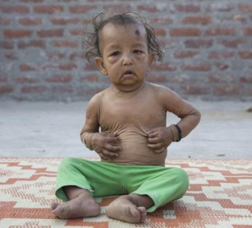 ¿Por qué los hermanos de la India parecen viejos? ¿Por qué los hermanos de la India parecen viejos?