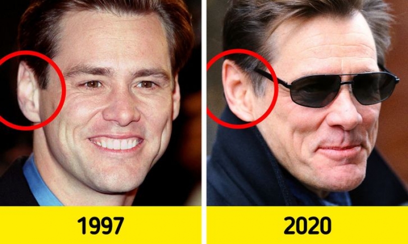 ¿Por qué nuestras orejas y nariz se agrandan a medida que envejecemos? ¿Por qué nuestras orejas y nariz se agrandan a medida que envejecemos?