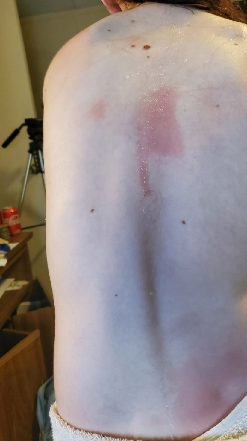 Problemas con el agua: una colegiala de Louisiana puede morir después de tomar una ducha