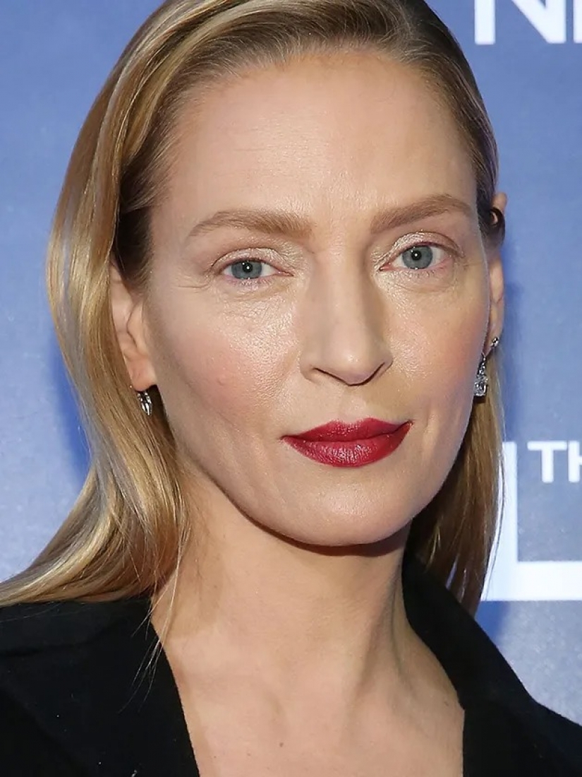 Retouching, scotch and botox: how stars deceive their fans