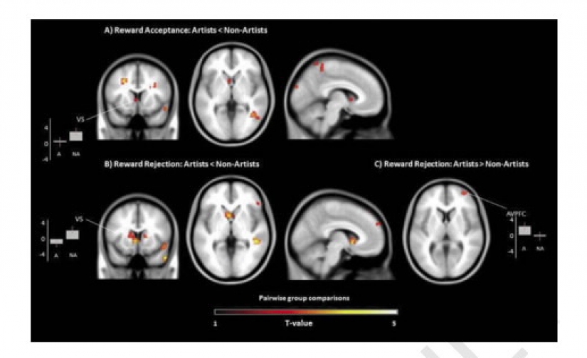 Scientists have found that the eyes can give away a person's sexual orientation