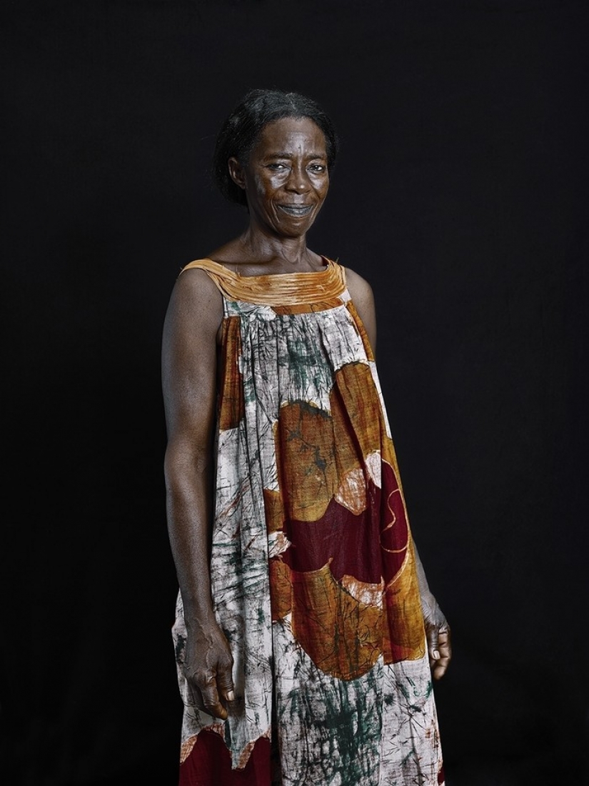 Shocking tradition of Cameroon-breast ironing