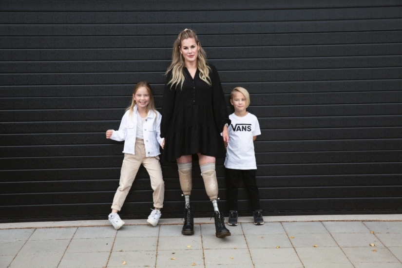 Sin piernas, pero con la voluntad de sobrevivir: ¿cómo una madre joven perdido una extremidad, pero no ha perdido el poder del espíritu Sin piernas, pero con la voluntad de sobrevivir: ¿cómo una madre joven perdido una extremidad, pero no ha perdido el poder del espíritu