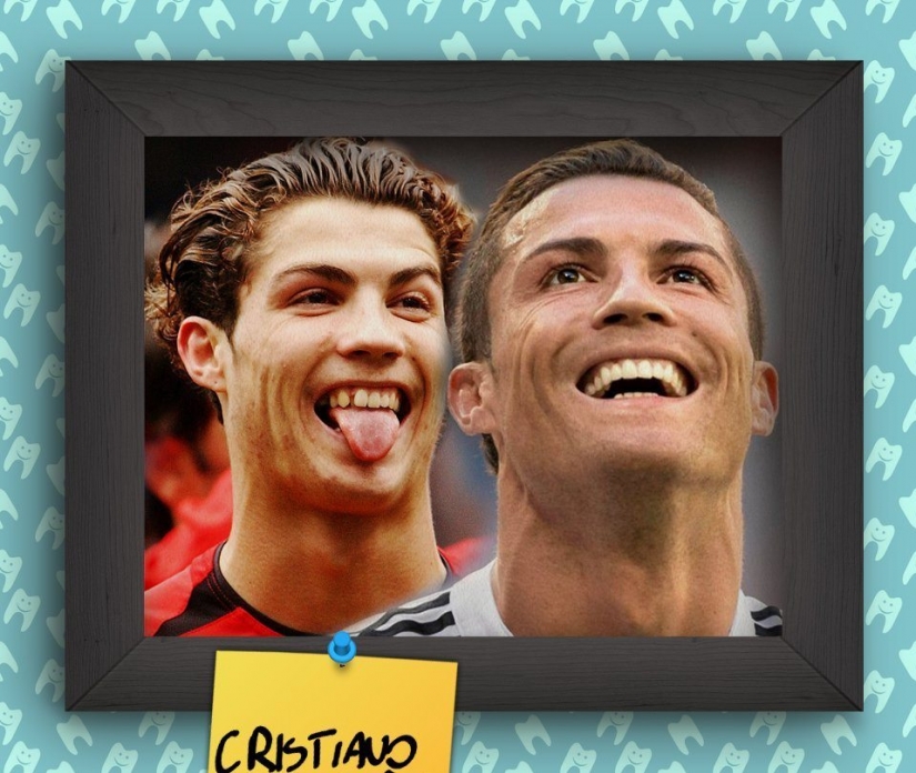 Sonrisas de estrellas ajenas a Hollywood al comienzo de sus carreras Sonrisas de estrellas ajenas a Hollywood al comienzo de sus carreras