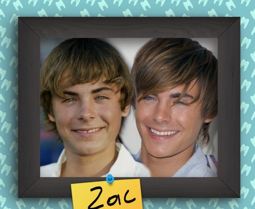 Sonrisas de estrellas ajenas a Hollywood al comienzo de sus carreras Sonrisas de estrellas ajenas a Hollywood al comienzo de sus carreras