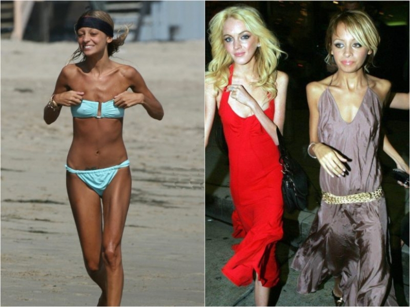 Star fever: which celebrities are faced with anorexia Star fever: which celebrities are faced with anorexia