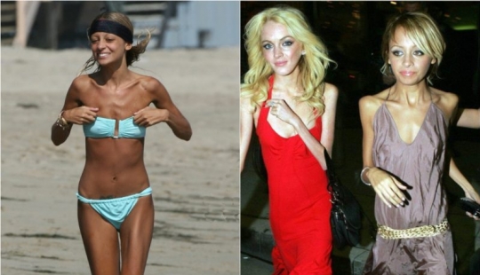 Star fever: which celebrities are faced with anorexia