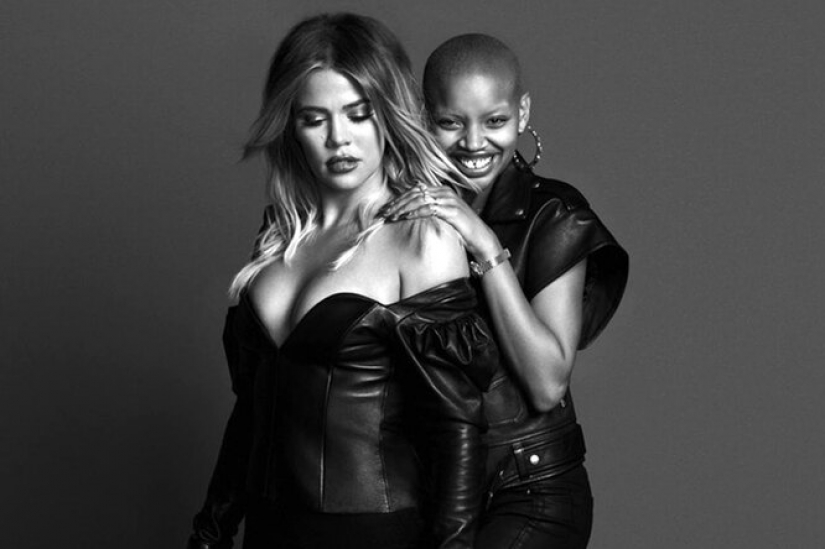 Strabismus, albinism, age: 5 models who tear the beauty template