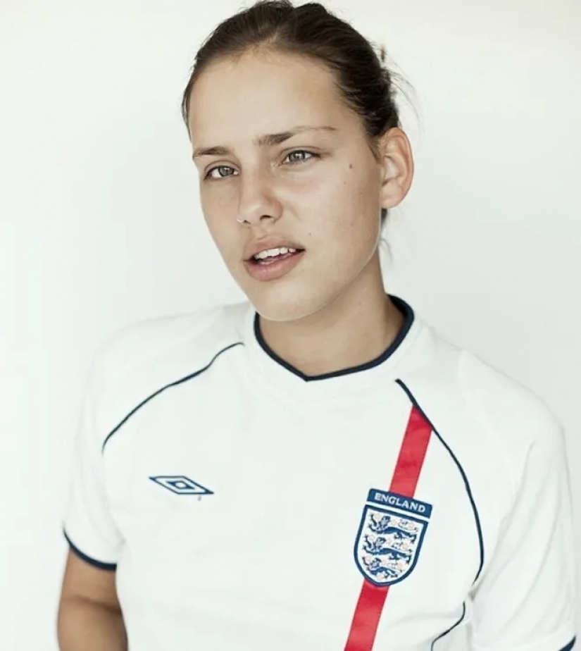 Strabismus, albinism, age: 5 models who tear the beauty template