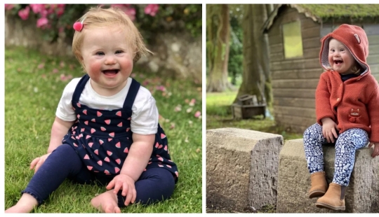 Sunny ray: A 2-year-old girl with Down syndrome has become the face of a fashion brand Sunny ray: A 2-year-old girl with Down syndrome has become the face of a fashion brand
