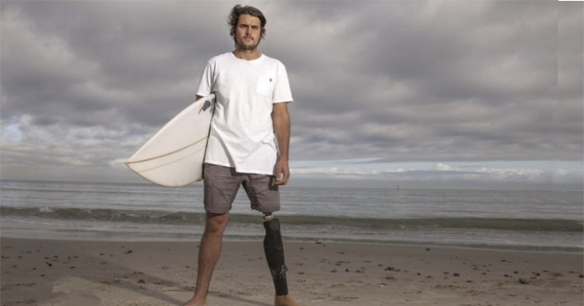 Surfer sues state for shark tooth that bit off his leg Surfer sues state for shark tooth that bit off his leg