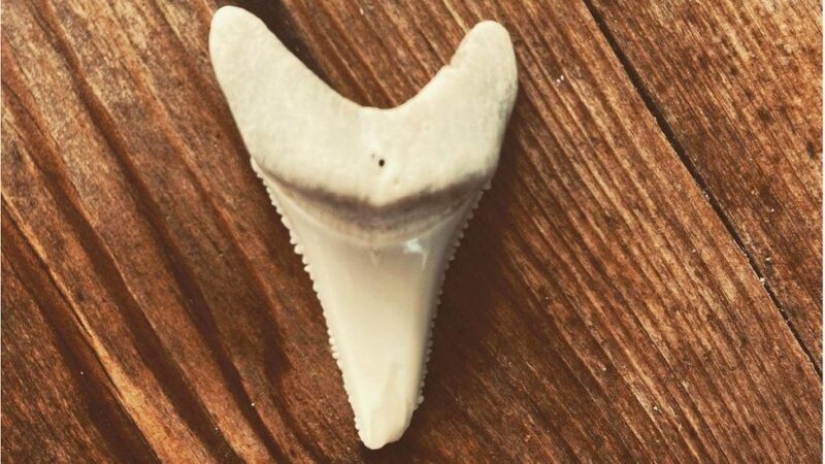 Surfer sues state for shark tooth that bit off his leg Surfer sues state for shark tooth that bit off his leg